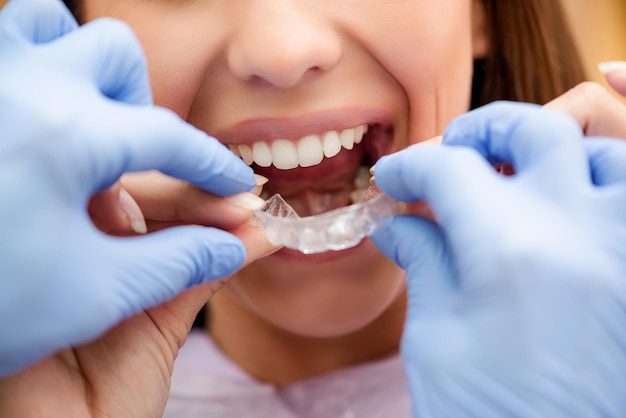 Dentista che mostra alla paziente come utilizzare l'apparecchio ortodontico mobile per la correzione dentale. Avvicinamento.