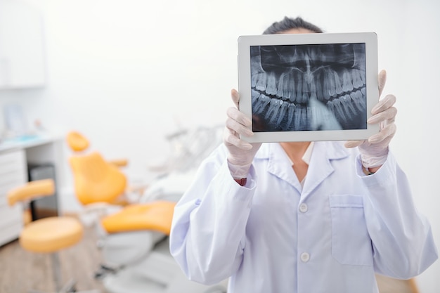 Dentista che tiene compressa digitale con i raggi X dei denti sullo schermo e cerca qualsiasi infiammazione