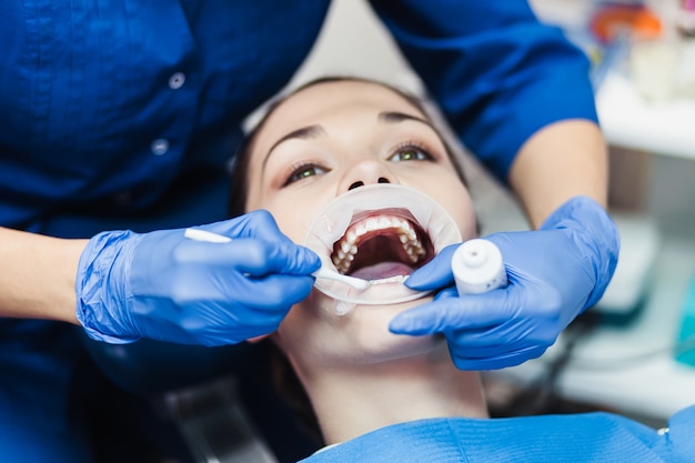 Dentista che tiene la procedura di sbiancamento dei denti