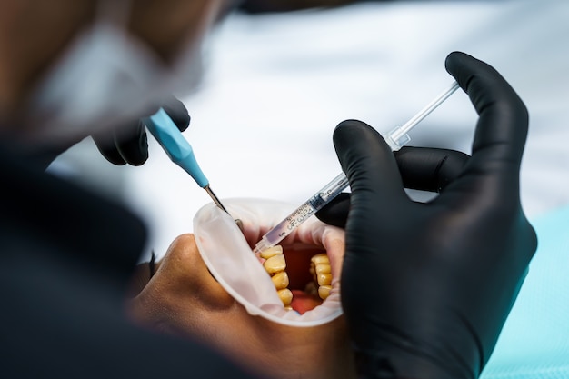 Dentista con cliente in uno studio dentistico. Igiene orale, denti sani, concetto di stomatologia.