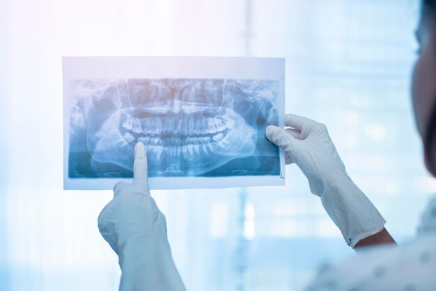 Dentista donna con una radiografia dentale