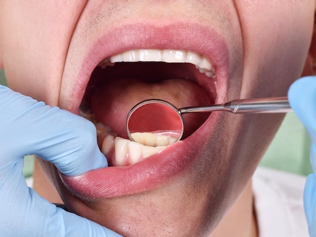 Dentista esaminando denti del paziente