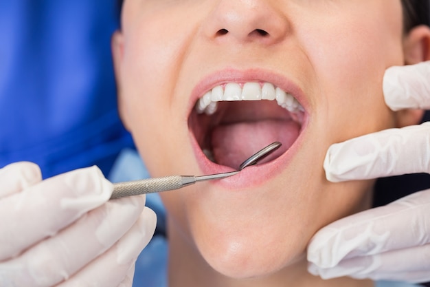 Dentista esaminando un paziente con specchio angolare