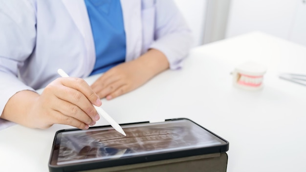 Dentista presso la clinica odontoiatrica Dente sano bianco con modello dentale in chirurghi orali che discutono dei raggi x della mascella sul concetto di chirurgia orale sanitaria della medicina tablet