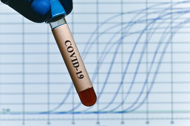 Diagnostica PCR COVID19