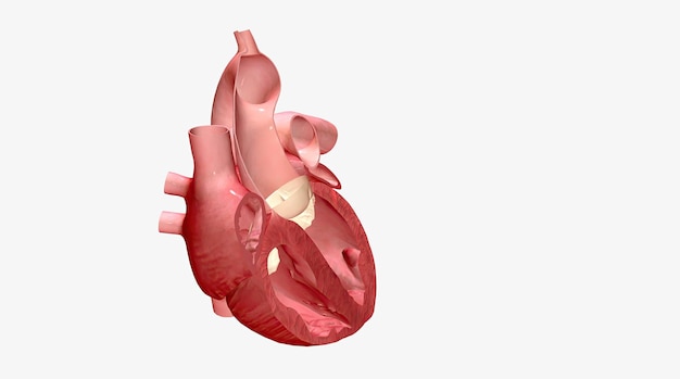 Diverse condizioni cardiache possono causare l'ispessimento del setto cardiaco