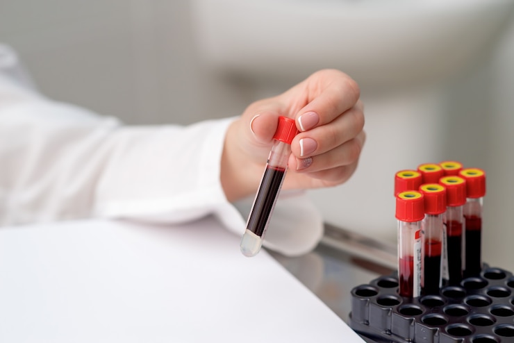 Doctor takes blood sample tube from tray on the table.