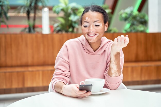 Donna afroamericana nera con problema di pigmentazione della vitiligine della pelle coperta rosa con cappuccio con cappuccio seduto al tavolo utilizzando smartphone