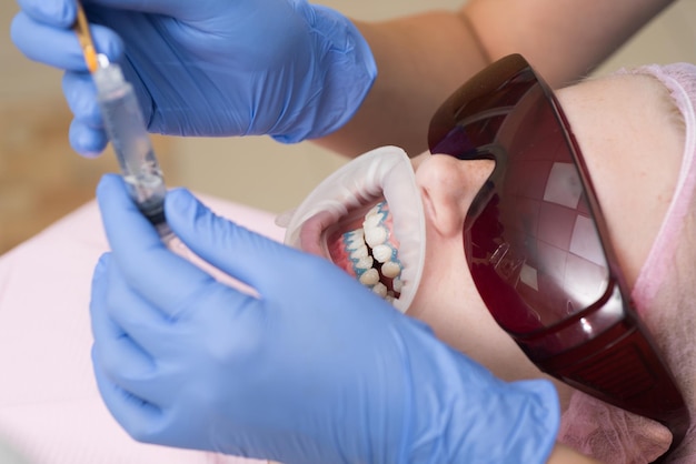 Donna che mostra i suoi denti bianchi dritti perfetti Closeup ritratto di una paziente in visita dal dentista per lo sbiancamento dei denti in clinica