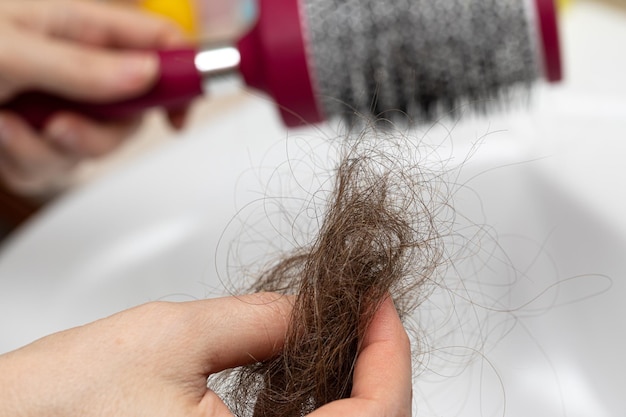 Donna che perde i capelli Mano con ciocca di capelli maculata