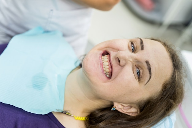 Donna dopo la procedura di sbiancamento che mostra i denti in odontoiatria