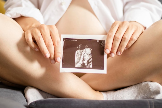 Donna incinta che tiene l'immagine ad ultrasuoni del suo bambino seduto sul letto. Primo piano