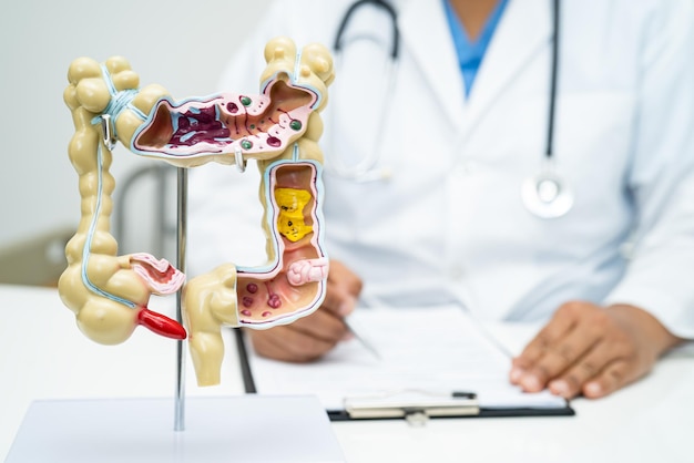 Dottore dell'appendice intestinale e del sistema digestivo con modello di anatomia per lo studio, la diagnosi e il trattamento in ospedale