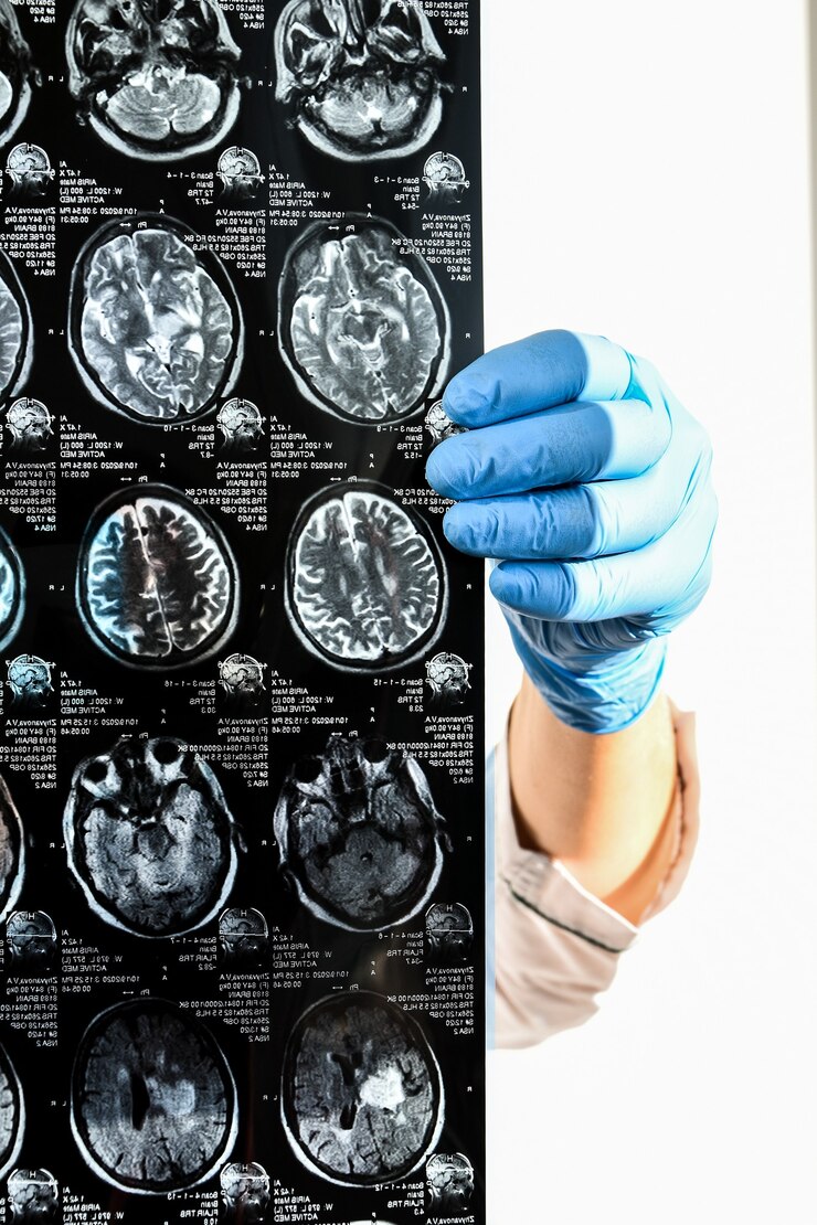 Dottore nella protezione dei guanti che tengono la risonanza magnetica cerebrale in studio medico. Scansione MRI della testa umana in clinica. Il neurologo professionista dà un consulente al paziente