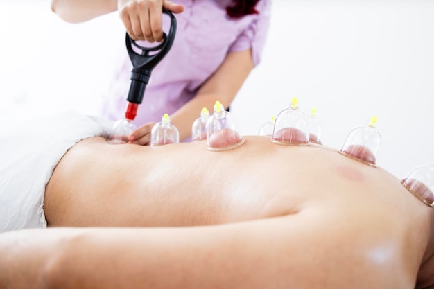 Esecuzione di terapia medica hijama con tazze e pompa a vuoto sul paziente per guarire il dolore alla schiena