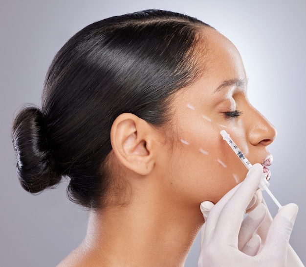 Filler viso e iniezione con donna in studio per chirurgia plastica dermatologia e bellezza Modello estetico e medico con modello e siringa su sfondo grigio per collagene e cosmetici