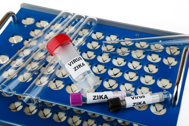 Foto concettuale del virus Zika con provetta
