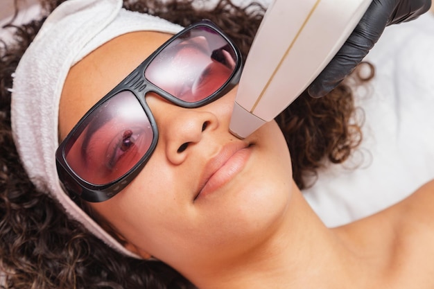 Foto del primo piano della donna brasiliana nera che esegue la depilazione laser sul labbro superiore