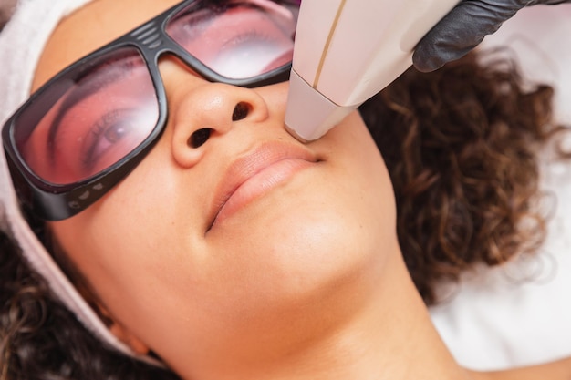 Foto del primo piano della donna brasiliana nera che esegue la depilazione laser sul labbro superiore