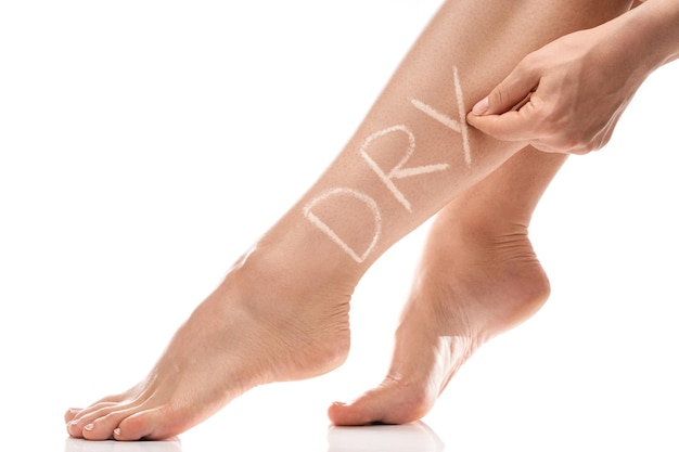 Gambe femminili con prurito e scritta DRY su di essa