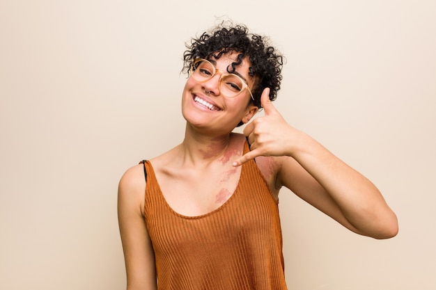 Giovane donna afroamericana con il segno di nascita della pelle che mostra un gesto di chiamata del telefono cellulare con le dita.