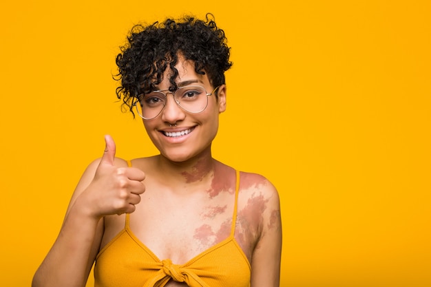 Giovane donna afroamericana con il segno di nascita della pelle che sorride e che alza pollice su