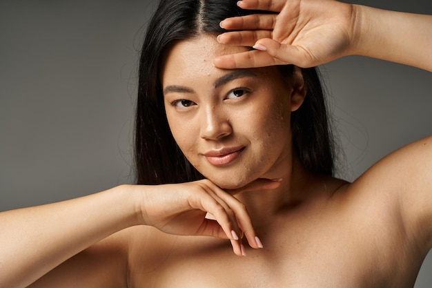 giovane donna asiatica con pelle soggetta all'acne e spalle nude che guarda la telecamera su uno sfondo grigio