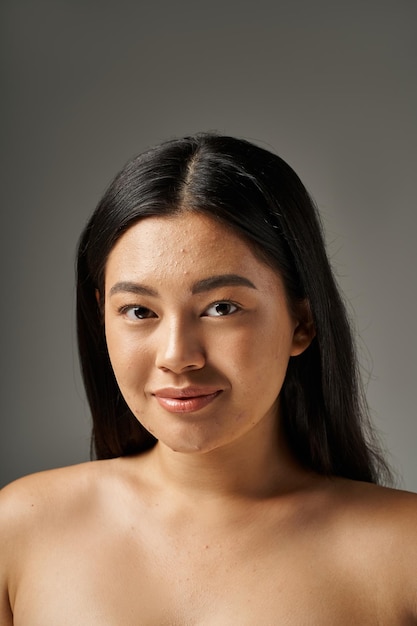 giovane donna asiatica felice con problemi di pelle e spalle nude che guarda la telecamera su uno sfondo grigio