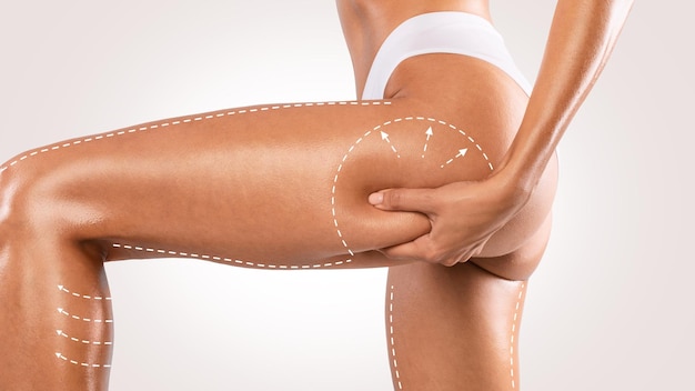 Giovane donna irriconoscibile che si pizzica le natiche esaminando la cellulite