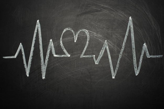 Grafico del battito cardiaco sulla lavagna utilizzando un concetto di penna per tenere traccia degli impulsi di uno stile di vita sano
