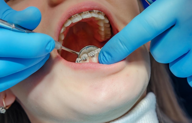 I denti in una clinica odontoiatrica sono installati