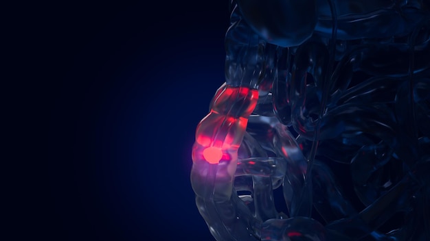 I visceri per il concetto medico di infiammazione intestinale rendering 3d