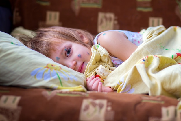 Il bambino che ha la varicella si trova in un letto e si riposa