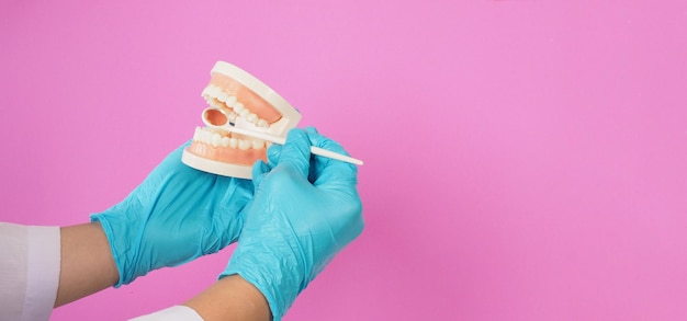 Il dentista è in attesa Modello ortodontico di denti e specchio dentale su sfondo rosa Indossare guanti in lattice blu