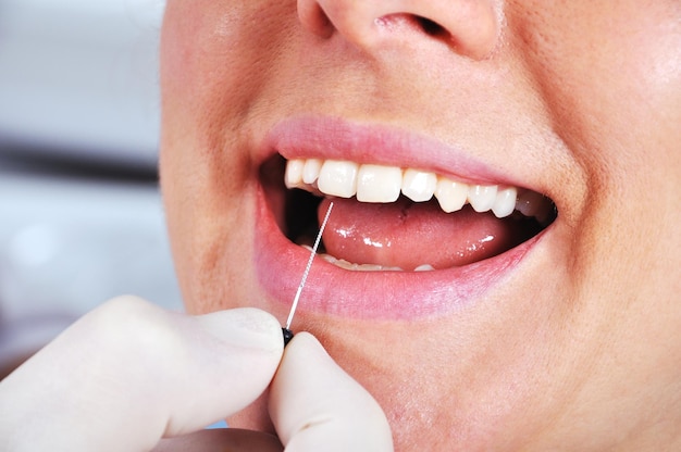 Il dentista esamina i denti