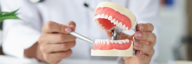 Il dentista mostra le aree problematiche nei denti sul concetto di cura della cavità orale della mascella artificiale