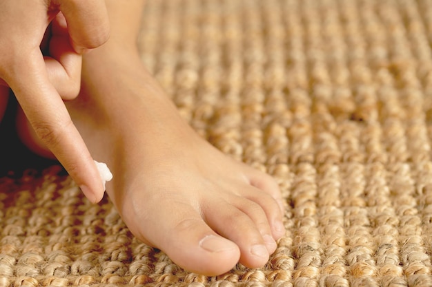 Il fungo del piede può essere trattato con farmaci antimicotici da banco.