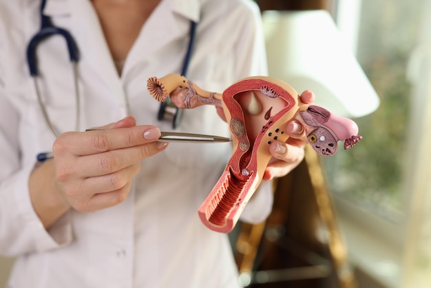 Il ginecologo dimostra il modello dell'utero nell'ufficio ospedaliero il medico conduce la lezione per il medico