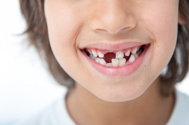 Il giovane ragazzo ha perso il dente