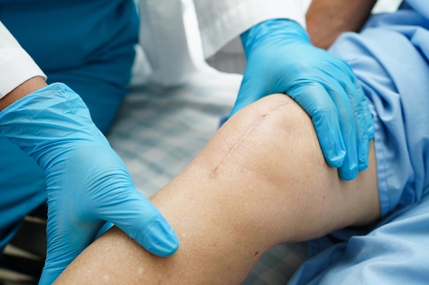 Il medico controlla una paziente asiatica anziana con una chirurgia di sostituzione del ginocchio con cicatrici in ospedale