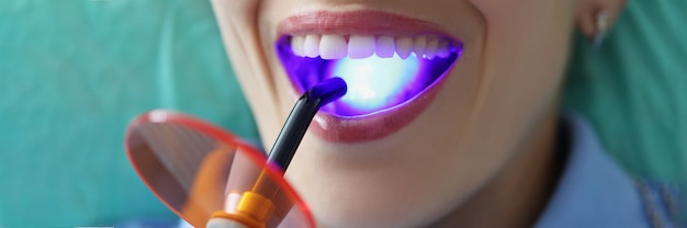 Il medico dentista riempie i denti del paziente con il primo piano leggero di polimerizzazione