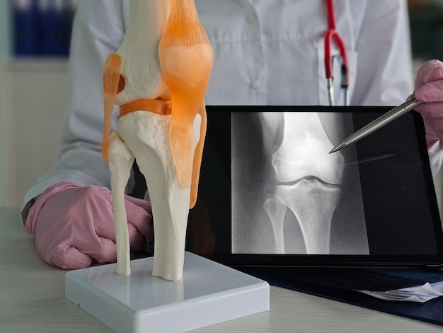 Il medico esamina il modello dell'articolazione del ginocchio durante la revisione della radiografia della gamba del paziente nel concetto di impostazione clinica