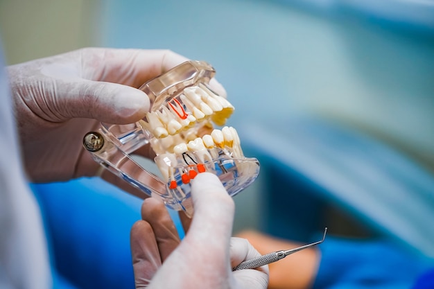 Il medico mostra su un campione di mascella di plastica o modella diversi metodi di trattamento dei denti