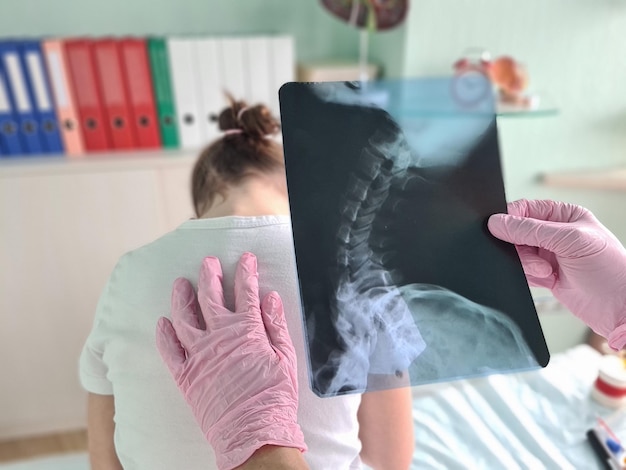 Il medico pediatra esamina i raggi X della deformità spinale del bambino