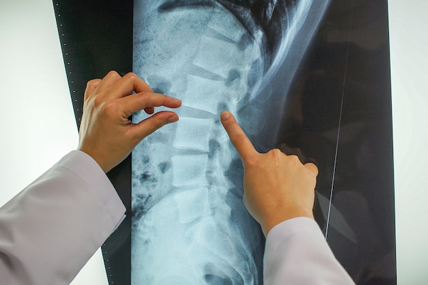il medico professionista sta spiegando i risultati della radiologia al paziente