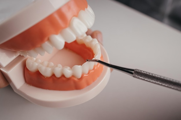 Il medico tiene il modello ortodontico dei denti e lo strumento dentale nel suo ufficio cure dentistiche Primo piano