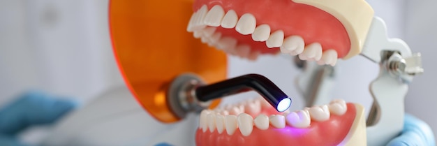 Il medico tiene la lampada uv dentale e della mascella per riempire il concetto di trattamento dentale della mascella dentale