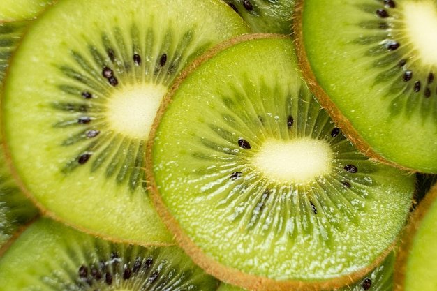 Il modello delle fette di kiwi tropicali Un'esplosione di freschezza verde