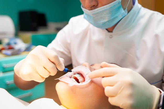 Il paziente con divaricatore per guance si trova sulla poltrona del dentista durante la procedura di sbiancamento dentale