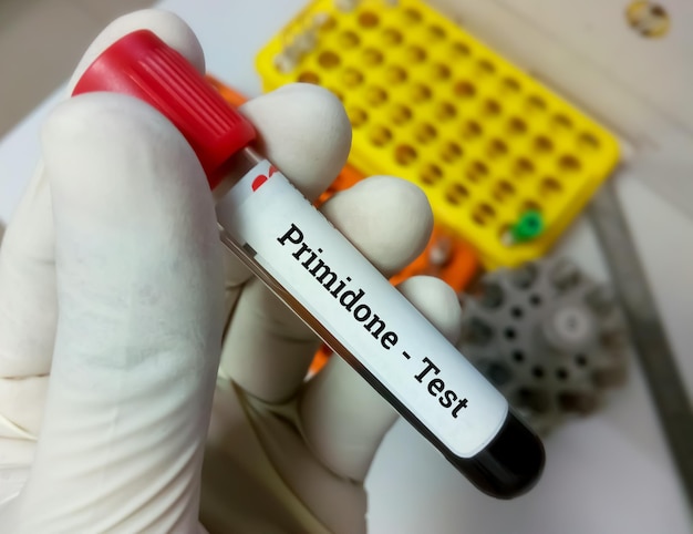 Il ricercatore tiene in mano un campione di sangue per il test del primidone per mantenere un intervallo terapeutico e una tossicità